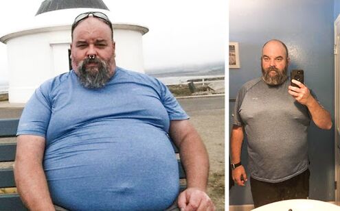 Photo before and after the Keto Probiotix course, the experience of using capsules with a Venice miger